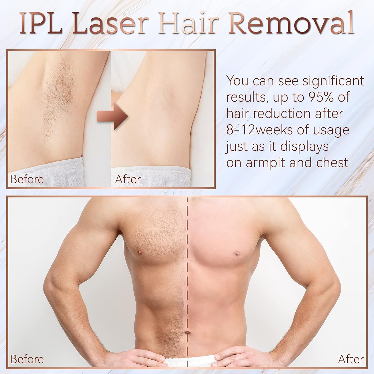 IPL Hair Removal, Laser Permanent Hair Removal for Women and Men, 999900 Flashes UPGRADED At-Home Hair Removal Device for Facial Legs Arms Whole Body Treatment